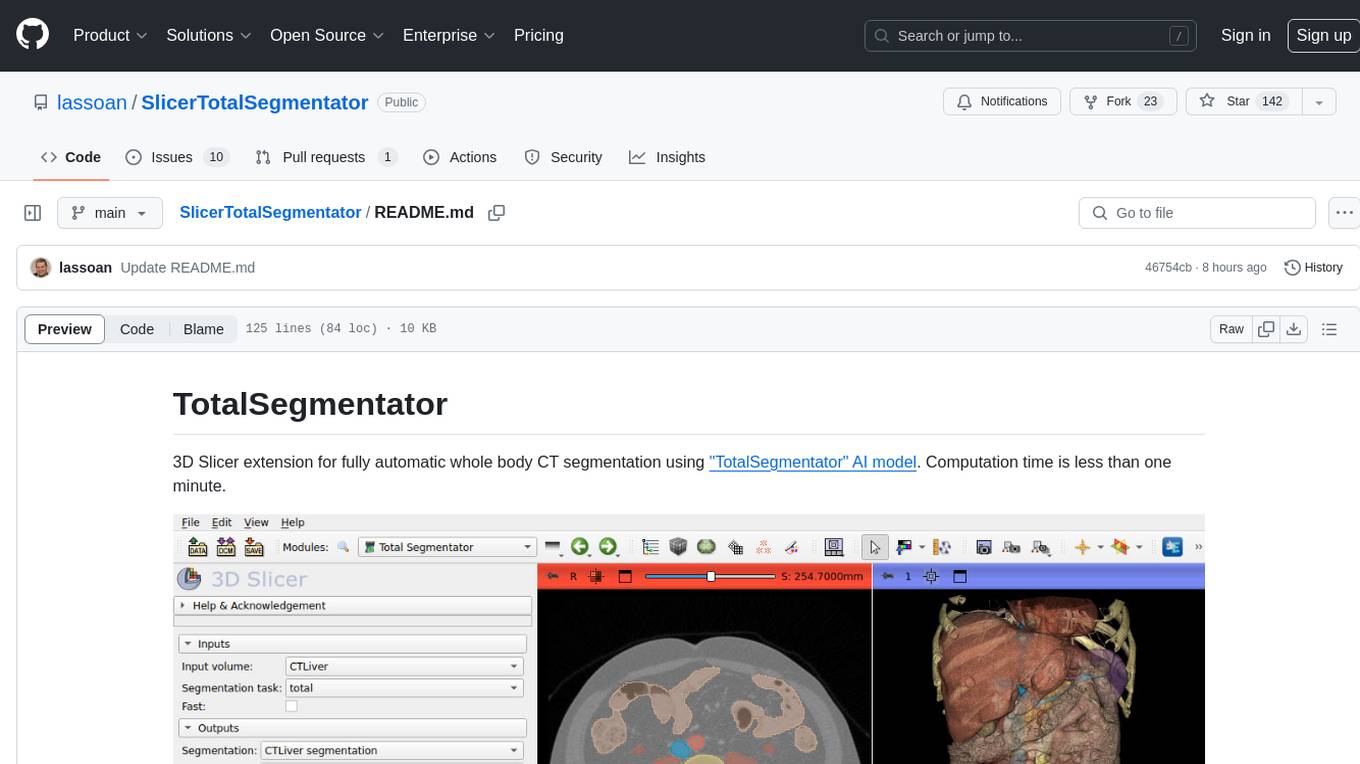 SlicerTotalSegmentator Screenshot